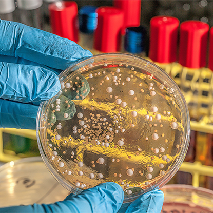 Terveys ja tautien valvonta